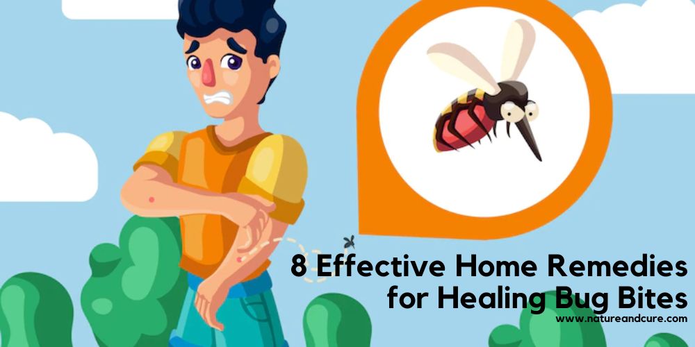 8 Effective Home Remedies for Healing Bug Bites - Nature & Cure