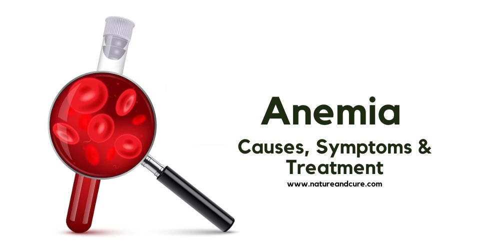 Anemia: Causes, Symptoms & Treatment - Nature & Cure